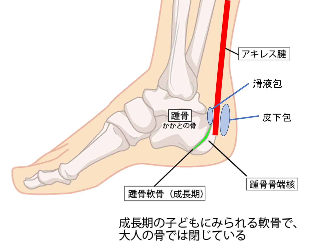 腱修復不全の症状は何ですか?